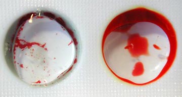 Bedisdetest Karte- Sinsheim - SD-nostik Bedisdetest Karte- Sinsheim - SD-nostik